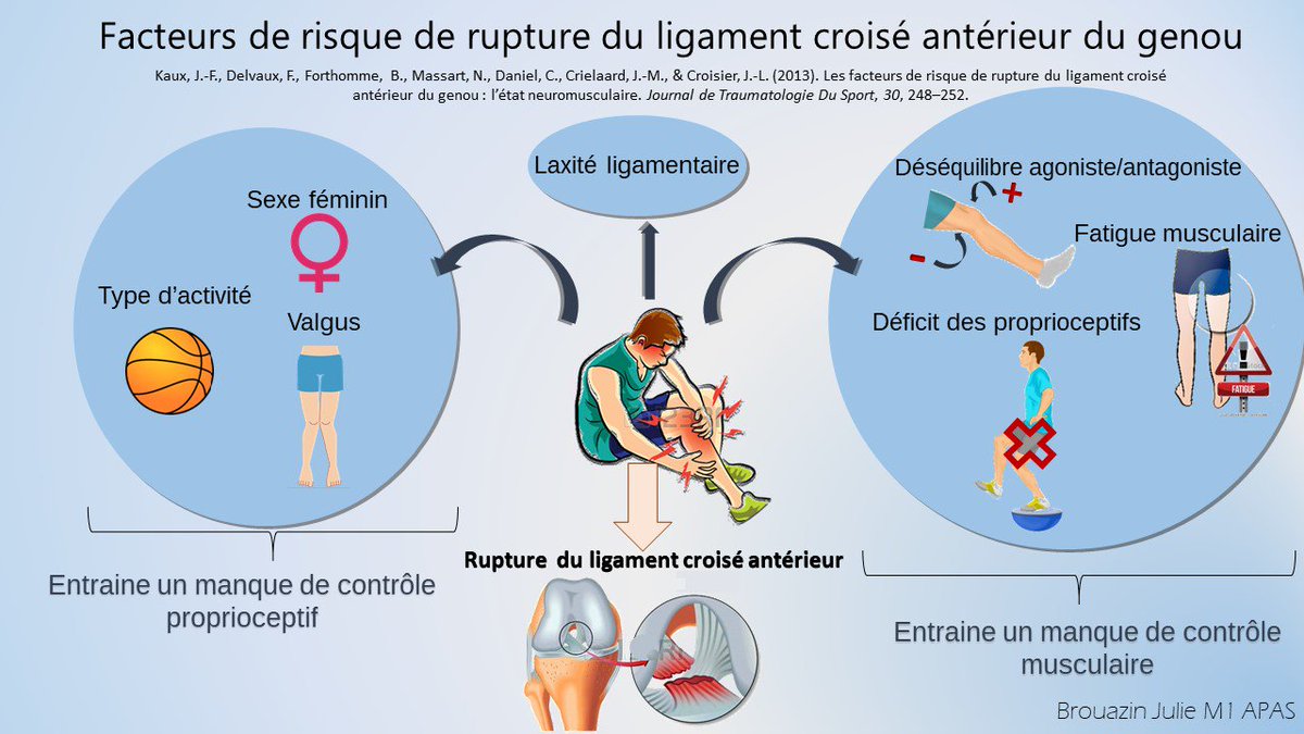 Julie_Brouazin's tweet photo. Facteurs de risque de rupture du LCA #M1APAS https://t.co/be1C4kVYXV
