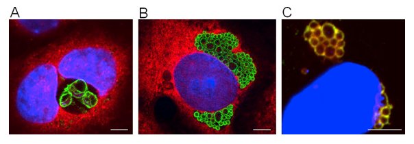 MicrobesInfect's tweet image. Chlamydiales, #Anaplasma and #Bartonella: persistence and immune escape of intracellular bacteria sciencedirect.com/science/articl… #chlamydia #immunology