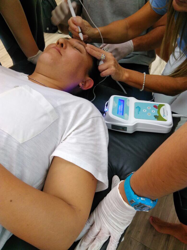 Microelectrolisis en estética <a href="/fisio_move/">Fisiomove</a> #arrugas #estrias #estriasbrancas #expresion #embarazo #estetica #medicinaestetica #MedicinaEstética