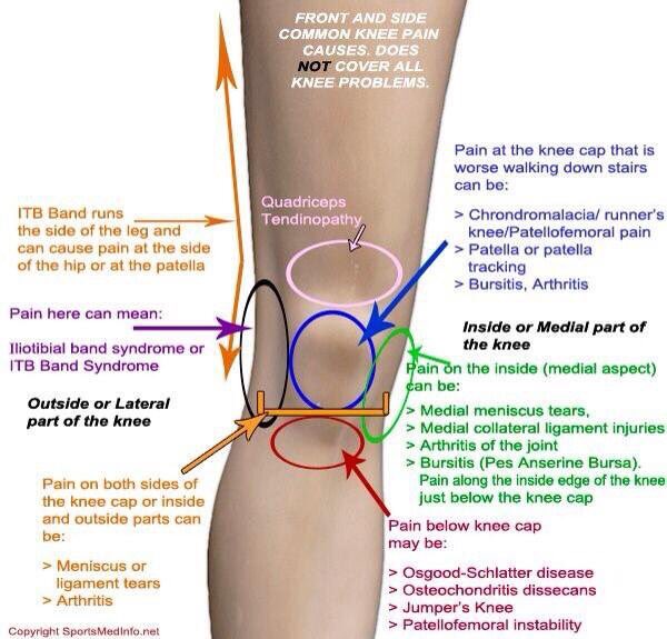 OsteopathyDerby's tweet photo. Knee pain https://t.co/vYQK5c5XlB