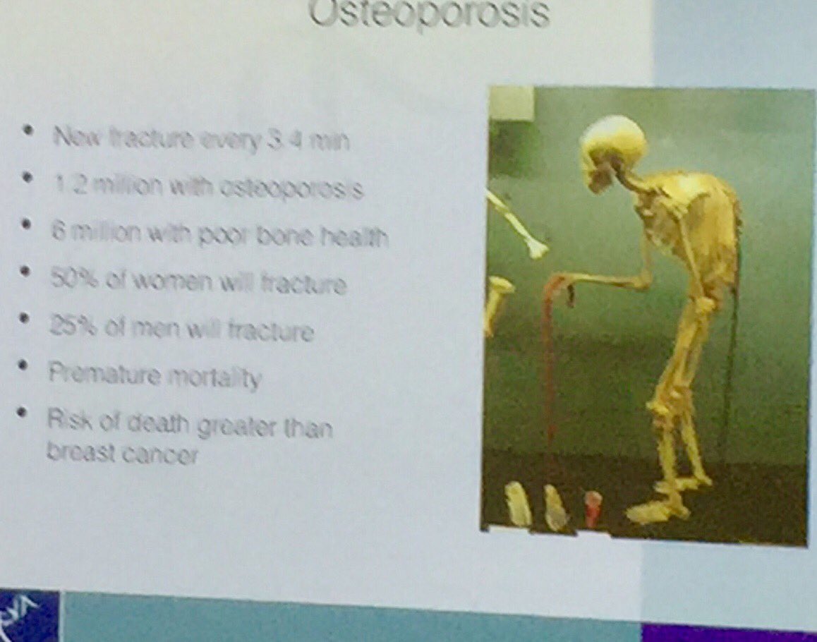 GarvanInstitute's tweet photo. #GarvanLISS Peter reminds us of the major public health problem that is #osteoporosis @osteoporosis_au #bone #skeleton #DubboStudy https://t.co/OeWSL1HQMh