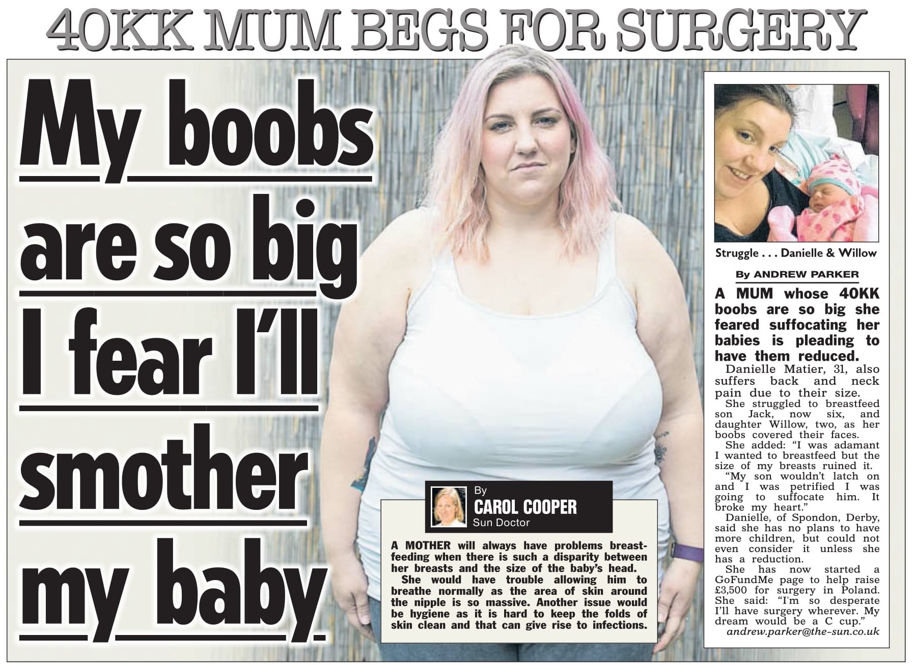 Mollie Caters News on X: By sharing Danis story of her breast reduction  dream, she has managed to reach her £3.5K target. If youve got a story to  share, get in touch!