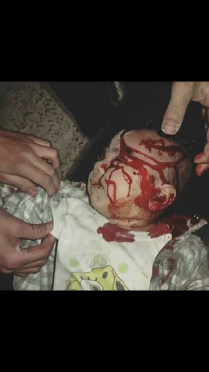 As_Alsharaa's tweet photo. #Syria6yearsOn nobody wants to do anything for #OppressedSyrians #SyriasChildren & all #TrappedInSyria are all insignificant by policy. #UN #ENICEF StopAssadCrimes PutinCrimes #Save ChildrenOfSyria https://t.co/pI9V0W6TPV