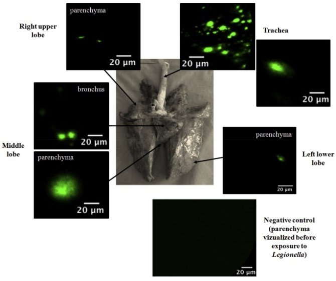 Deposition pattern of aerosolized #Legionella using an ex vivo human-porcine respiratory model mimicking human exposure by inhalation visualized with #Cellvizio bit.ly/2AatRjA 
#Infections #inVivoImaging