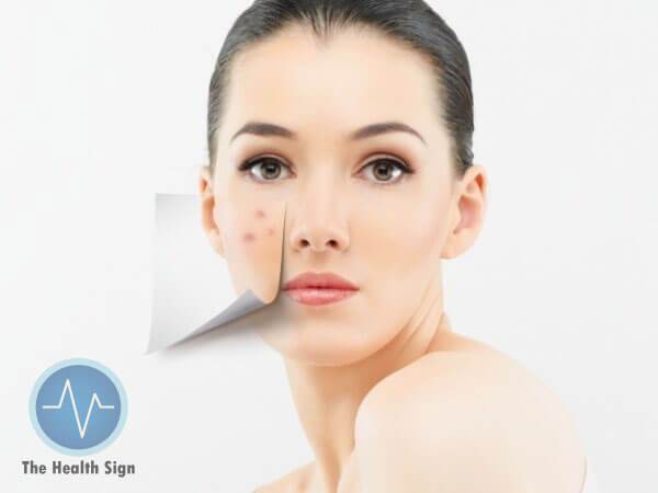 5 Most Popular Ways to Skin Pigmentation Treatment thehealthsign.com/skin-pigmentat…