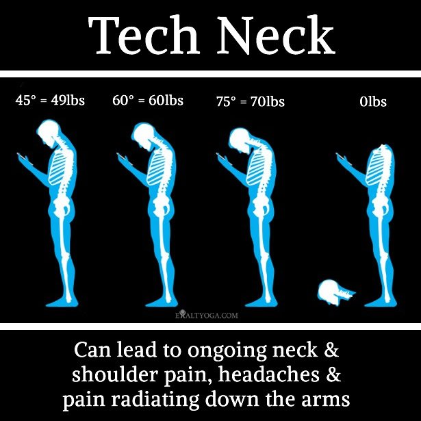 ExaltYoga's tweet photo. Funny. Not funny.

Tech neck is a very real issue affecting many of us today. It is responsible for tension &amp; migraine headaches as well as neck, shoulder and back pain. Learn more about how you can prevent it in your body - https://t.co/4BKLc8ZrDb 

#yoga #yinyoga #exaltyoga https://t.co/UwQ3rSHfIA