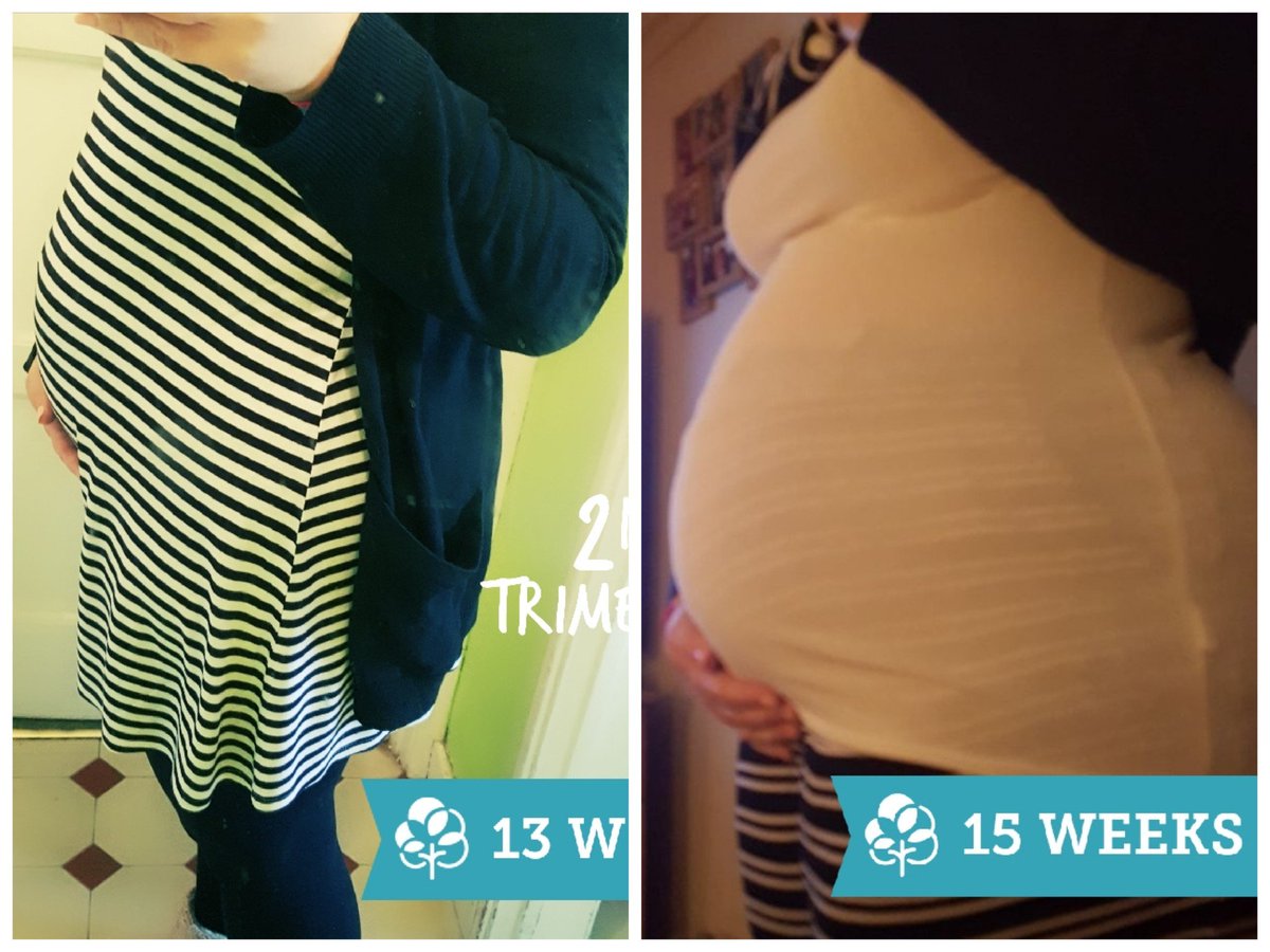 SpecialK211280's tweet photo. "Bumpy" has had a massive growth spurt this last 2 weeks me thinks..... 🙈🤰#bumpwatch #babyonway #Maybaby https://t.co/OuRKRnN6DX