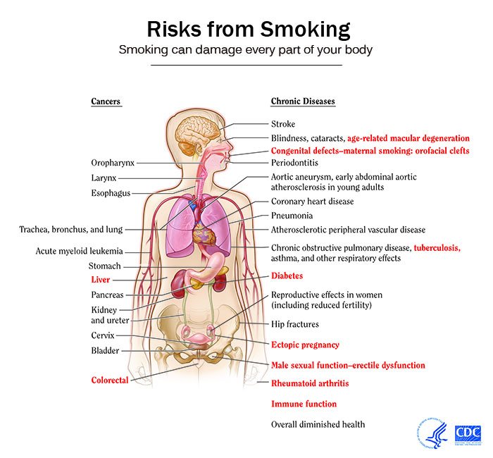 NCIDirector's tweet photo. After years of litigation, major US #cigarette companies have begun issuing “corrective statements” on the detrimental effects of #smoking on health. Much of the science relied on in the trial &amp; in the dev’t of the statements was provided by @theNCI https://t.co/NfAMjljfC5 https://t.co/eejRNdVzF4