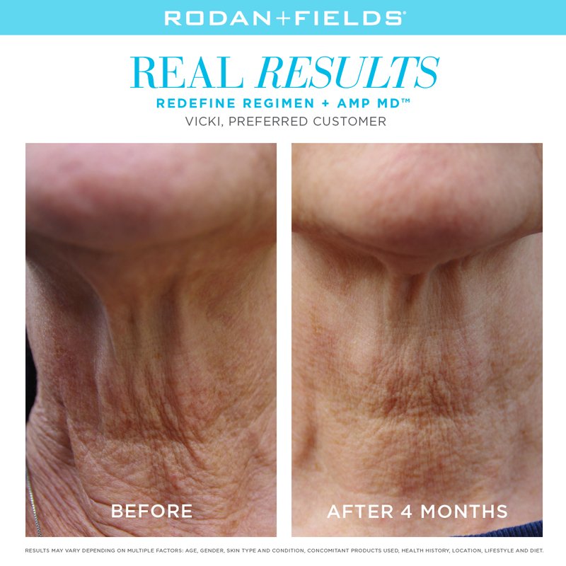RodanFieldsHQ's tweet photo. The #AmpMD System reveals visibly firmer, younger-looking skin in as little as four weeks. Learn more: https://t.co/vKcejwDgWE. #RodanandFields https://t.co/xAerYDidWm