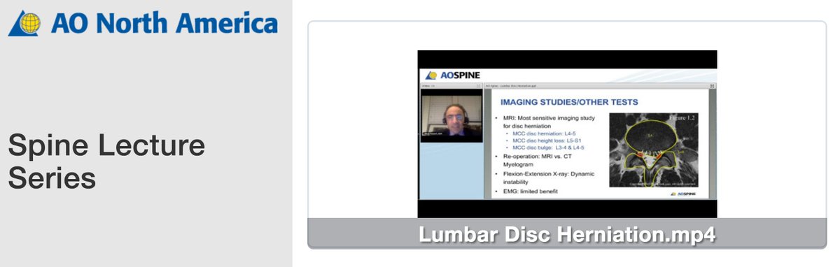 MMC/AECOM Neurosurg (@monteneurosg) on Twitter photo AO North America Spine Lecture Series: "Lumbar Disk Herniation" by Dr. Reza Yassari
aona.widencollective.com/c/qynewpub
<a href="/AONorth/">AO North America</a> AO North America Spine Lecture Series: "Lumbar Disk Herniation" by Dr. Reza Yassari
aona.widencollective.com/c/qynewpub
<a href="/AONorth/">AO North America</a>