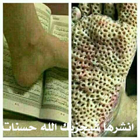 abdalwasa22921's tweet photo. https://t.co/ObPyLOLN7j