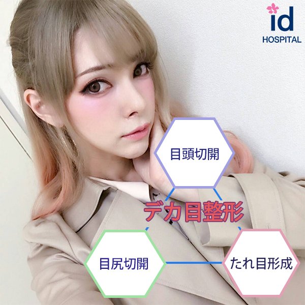 Id美容外科 No Twitter くっきりぱっちりした目になるにはデカ目整形がおすすめ 日本人モニター症例写真 T Co Wuei8dkl 韓国整形 美容整形 目整形 目頭切開 目尻切開 たれ目形成
