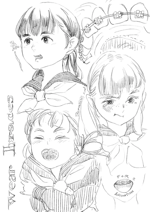 矯正器から解放されたよ!きねん。 