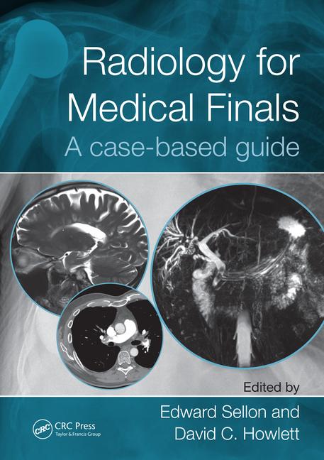 CRCRevision's tweet photo. Looking for a new #Radiology revision guide? Check out 'Radiology for Medical Finals: A case-based guide' which is available now! https://t.co/Bu6y64NPRa https://t.co/6F2a4a10n0