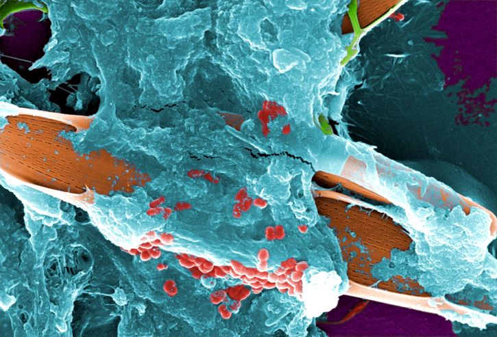 OneLIFEBF's tweet photo. OneLife aide les dentistes à annihiler le #biofilm, la cachette de 99.9% des bactéries : Sur les instruments, surfaces ou les aspirateurs. Il est crucial de désintégrer les biofilms, sans ça: vive la transmission...
#AFD2017 https://t.co/uH4telSEzg