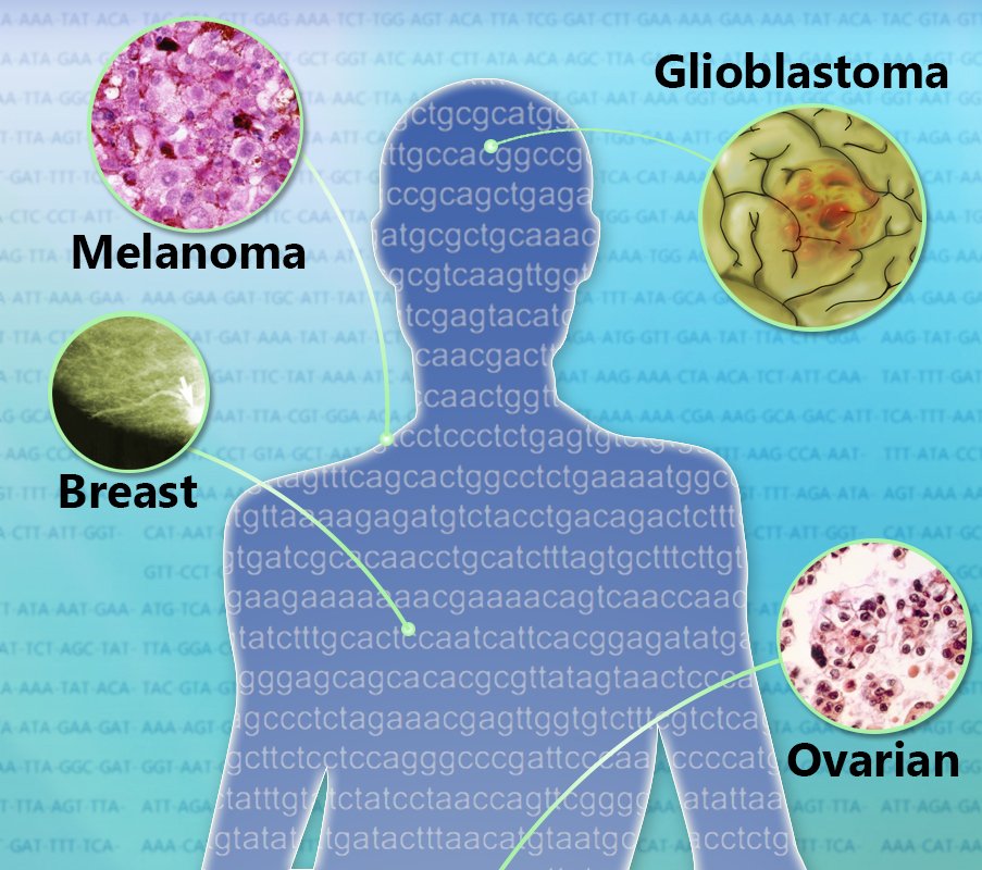 theNCI's tweet photo. Clinical trial aims to learn if adding #immunotherapy and vaccine to #glioblastoma therapy increases survival rate: https://t.co/6vZuwSbYLh https://t.co/BcSUjoD9cf