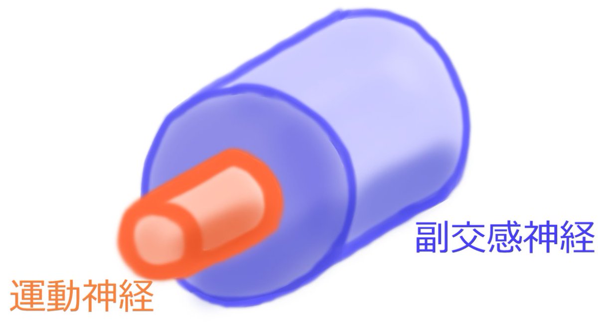 東北どまんなか 総合診療勉強会 動眼神経 見た目は一本ですが 実は2つの神経線維が合体しています 内側が運動神経 の線維 外側が副交感神経の線維です だから 動脈瘤で外側から圧迫されれば散瞳 眼瞼下垂が 糖尿病で内側が虚血になれば外眼