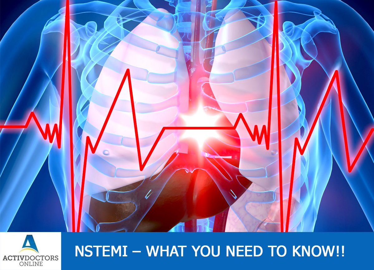 ADOIndia's tweet photo. #ActivHealth #HeartAttack
NSTEMI – What You Need To Know!!
Heart attack is the leading cause of death in developed, developing and
underdeveloped countries!!
Read More : https://t.co/T59HINEJGJ https://t.co/MNtcTMnrpr