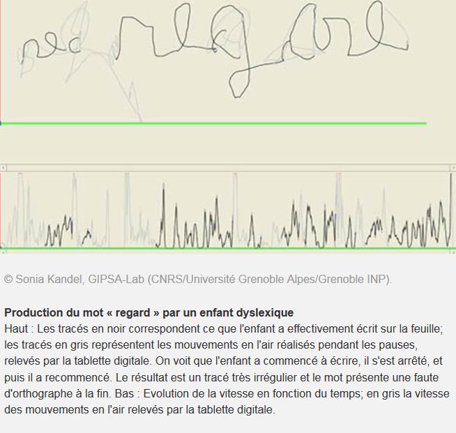 Dyslexie : quand les difficultés en orthographe gênent l