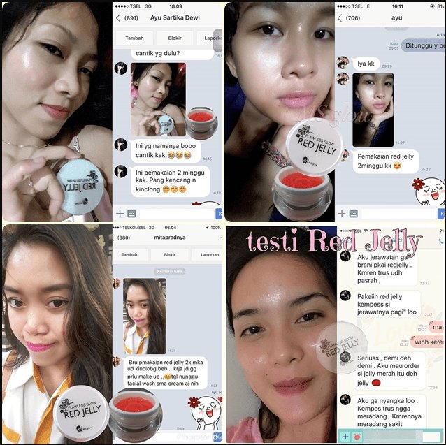 Jual Set Perawatan Wajah MS Glow Di Banjarmasin WA 082115461729 trulumsynerprof.com/jual-set-peraw…