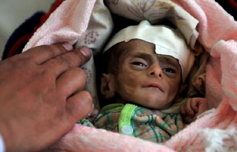 Suziabikhalil's tweet photo. We require from @Pontifex a message of peace to #Yemen and a visit to this country who is being devastated by #KSA https://t.co/zyorWBS3Vh