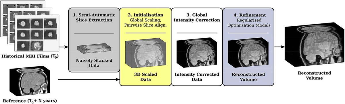 #FOAMrad #MS Dusty old film printed #NeuroRad #MRI can be converted into geometrically consistent volumetric images suitable 4 postprocessing. Slice extraction/slice-to-volume registration/inter-slice transformation regularisation. Good work <a href="/renbeleahcim/">Michael Ebner</a> 
doi.org/10.1016/j.neur…