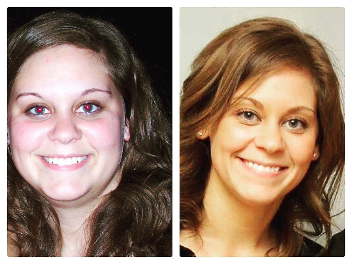 ForeverWellBoca's tweet image. We're excited to welcome Sarah Weiss (RD/LDN, RYT) to our Forever Wellness family! With the purchase of any of our LED light treatment packages, Sarah will customize a weight-loss plan for you. Call (561) 245-7175 or email: info@foreverwellness.com to book your first session FREE