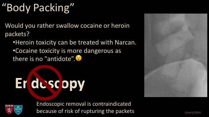 I am excited to arrive at RSNA today!  I have been a bit FOMO while following other's tweets.  Here is a fun case from a talk I'll be giving on Friday.  Most of you will be home...but maybe by the virtual meeting.  Someone has to be last...😀