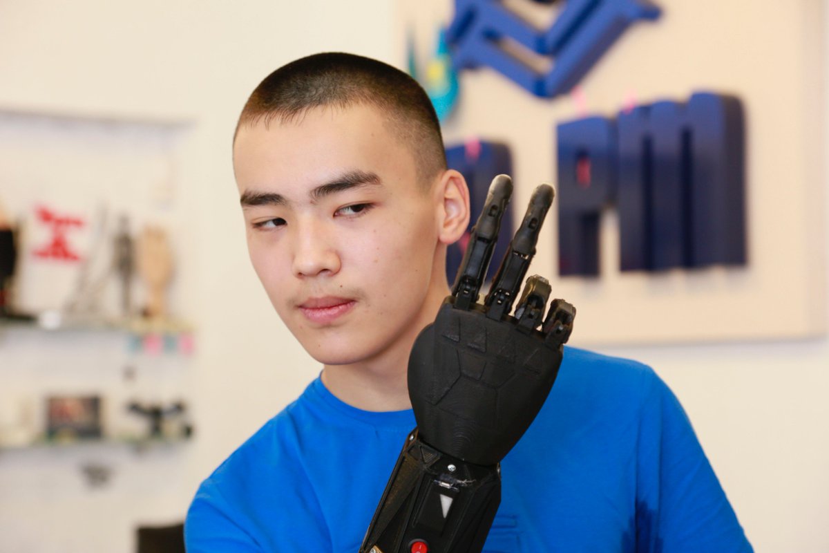 TheAstanaTimes's tweet photo. #MBionics creates Kazakhstan’s first #bionic prosthesis
https://t.co/yJOklcMH56
#Kazakhstan #BionicProsthesis #100newfaces https://t.co/eIq8Bkb0Dx