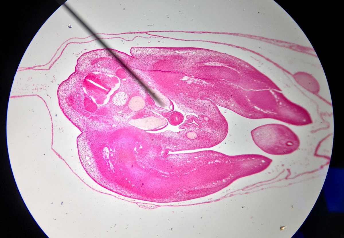 j11p43f's tweet photo. Here’s something you don’t see every day. A microscope slide of a five day old chicken embryo! Possibly the strangest find in my schools collection!
#MicroscopeScience #BiologyIsAmazing https://t.co/c3pPJzlFaq