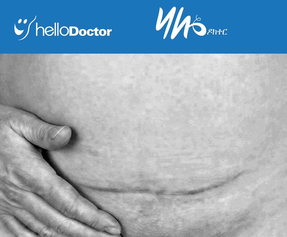 Hello Doctor Ethiopa tweet media