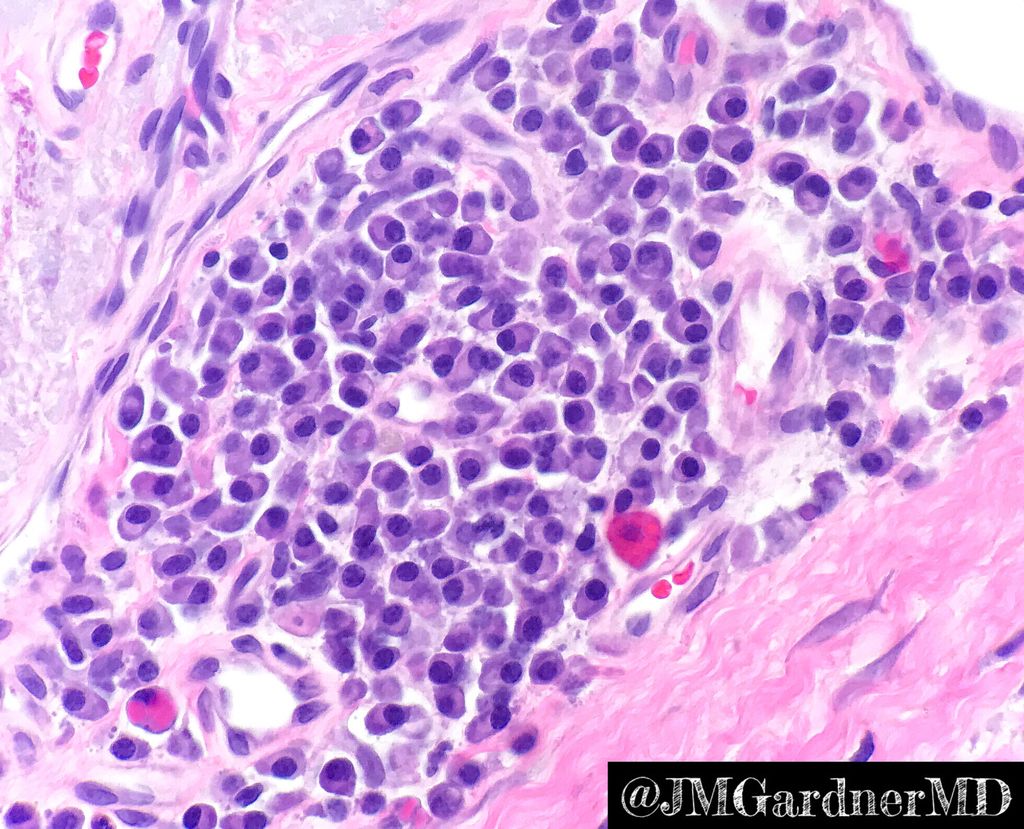 JMGardnerMD tweet picture
