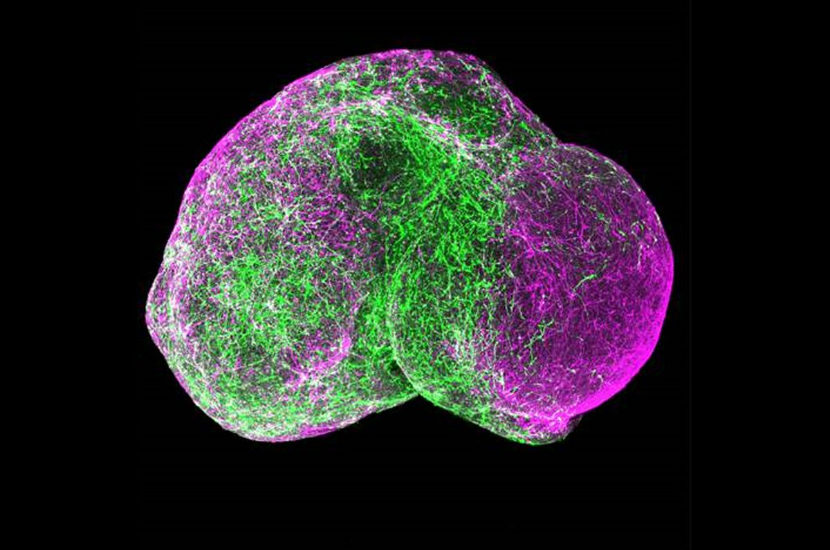 AutismTechTalk's tweet photo. #AutismTechnology: $5 million grant from NIH will enable UCLA to develop new models for autism
 - https://t.co/gX5E6yNZKh https://t.co/09IRquIhhq