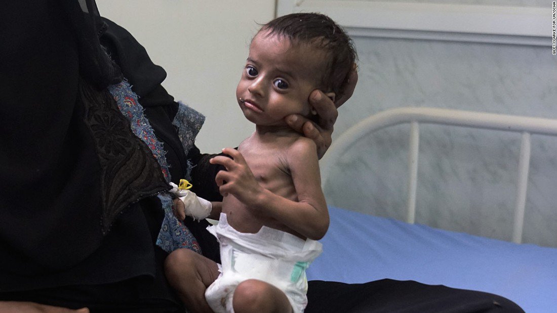 anger_24's tweet photo. Yemen: Million children at risk from cholera, charity says
https://t.co/NCbpcX16Tb https://t.co/KNLkIUui1n