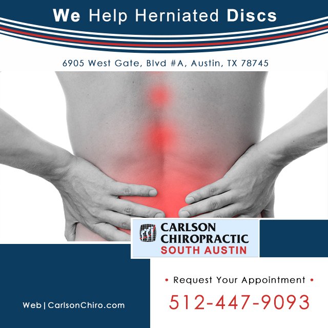 CarlsonChiroTX's tweet image. Did you know that the vast majority of #NeckPain &amp;amp; #BackPain patients do not require surgery? #SpinalDecompressionTherapy is a safe, gentle, non-surgical &amp;amp; hands on approach to treating neck &amp;amp; back pain: 512-447-9093 #AustinChiropractor