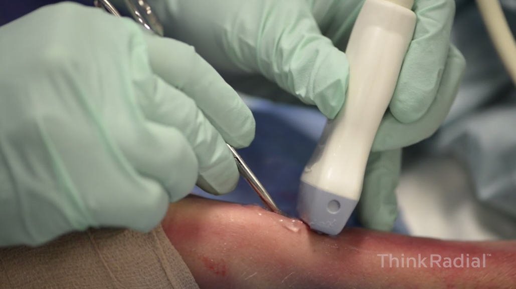 ThinkRadial's tweet image. Expand your horizons in 2018 at #ThinkRadial. Reserve you spot today before it's too late.  Get hands-on radial training specialized for both Interventional Cardiologists and Interventional Radiologists. #RadialFirst ow.ly/x36630hbIPF