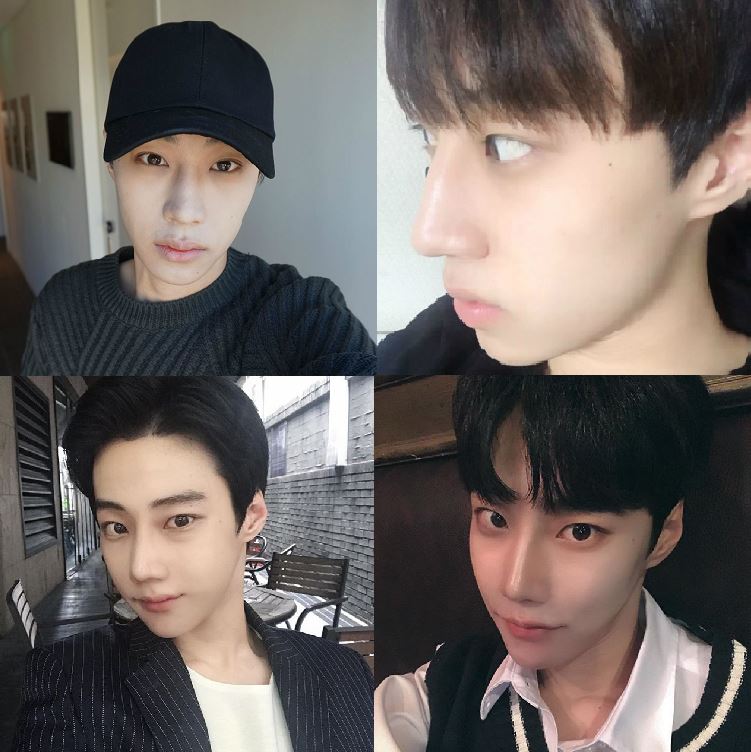 ナビコリア 韓国美容整形 無料サポート 08年から V Twitter メンズ整形 Id美容外科のbefore After ナビコリアが整形サポートします 5 無料宿泊 お問い合わせはこちら Line Park Gyu Ri 輪郭手術 ダウンタイム 韓国整形 整形サポート V