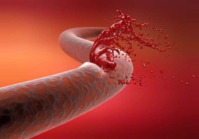Se aprueba un nuevo medicamento para tratar la hemofilia A <a href="/MPcontrol_/">MPcontrol</a> 
bit.ly/2Ahr98w