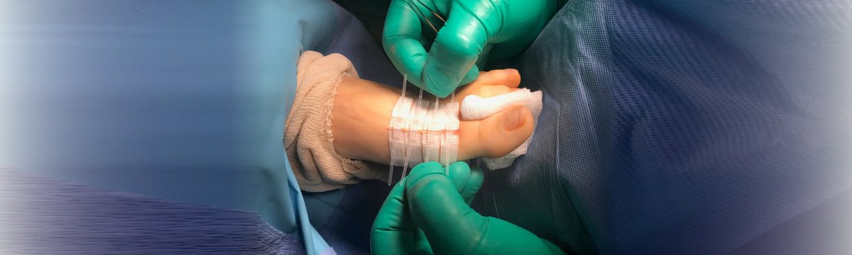 DermaClip's tweet image. Traumatic arm laceration, C-section on a surgical mission, an abdominal wound, or more such #wound_treatment. DermaClip® non-invasive skin closure device is effective for a wide range of wound-closure applications!dermaclipus.com