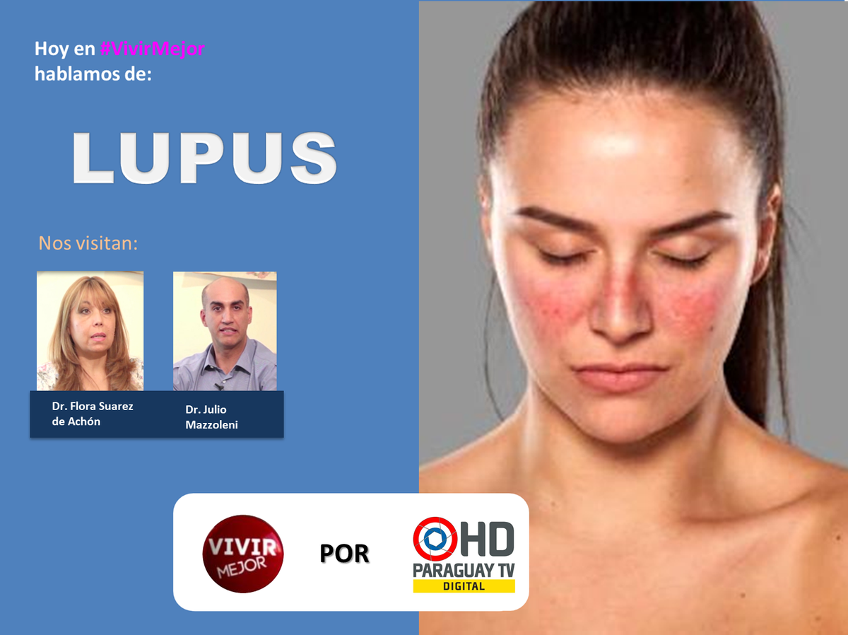 ¡Ya arrancamos #VIVIRMEJOR por <a href="/ParaguayTVHD/">Paraguay TV</a>! Hoy nos acompañan los doctores Dr. Julio Mazzoleni y Flora Suarez de Achón para hablarnos del LUPUS. Nos vemos 📺😀👌