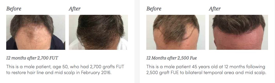 KensingtonHairClinic on Twitter: KensingtonHairClinic on Twitter: