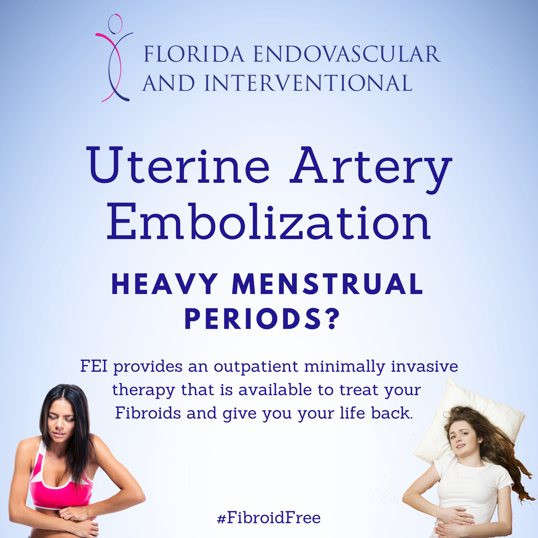 Flendovasc's tweet photo. Dealing with heavy menstrual periods?  Did you know there are new options?  #uterinearteryembolization #fibroidfree #fibroidhealth #minimallyinvasivesurgery https://t.co/bejadTxNqz