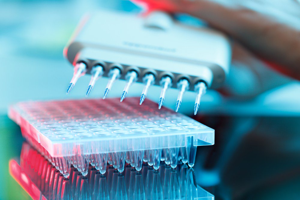 Curie Institute Is Partnering with Agendia on Breast Cancer Test Processing Study breastcancer-news.com/2017/12/13/age…