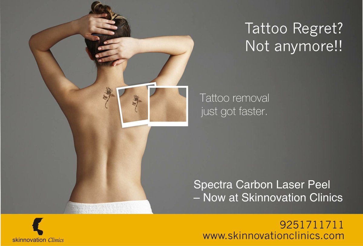 SkinnovationC's tweet photo. 1. Tattoo Removal with state of the Art, US FDA approved, Spectra XT - For the first time in North India, only at Skinnovation Clinics.
Queries: 9251711711 | https://t.co/25SyboQRa9
#SpectraXT #SkinnovationClinics#PigmentationCorrection #TattooRemoval #AcneTreatment https://t.co/wj2BG2xG97