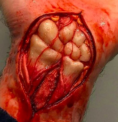 Galiendu38's tweet photo. Pour ceux qui avaient du mal à visualiser les os du carpe https://t.co/NgvmKnBXNB