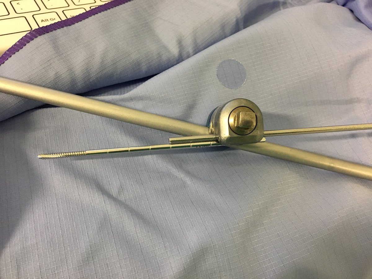 PhilipHenman's tweet photo. @OrthNorth1      Top tip. In emergency/MI/tent with open child ## you can use adult fixator with 3mm pins by ‘packing’ pin clamp with a 2nd wire or pin. NB not for routine use or recommended by manufacturer! #childtraumacourse https://t.co/O9LfwoK26t