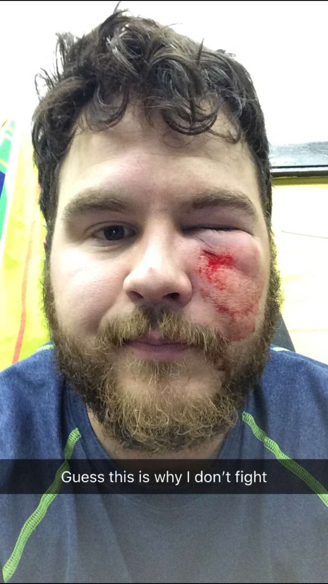 IrmaSrAces's tweet photo. Boys rolled outta sedgewick last night with a 5-2 victory! Shout out to @scottstady for injuring someone’s hand with his face! #youshouldseetheotherguy https://t.co/LSB1BfmZvT