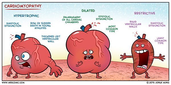 SEMDocs's tweet photo. Cardiomyopathy #medcomic #medbullets #sportsmedicine https://t.co/rMoMpuexYE