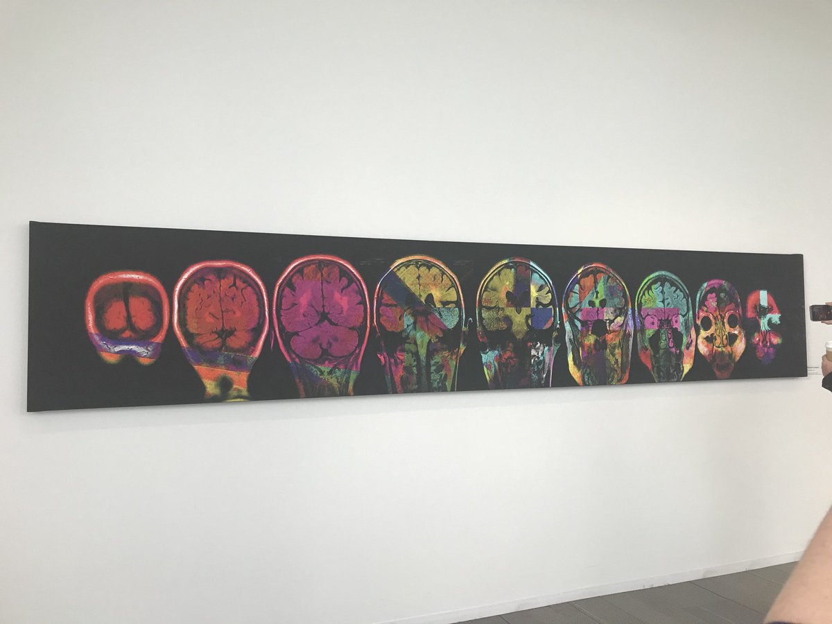 iamalisonmack's tweet photo. A beautiful piece of #SciArt at the #NIH in DC. The artist was diagnosed with #MS and made some amazing works from her #MRI scans. This piece particularly speaks to me because someone I love has MS too. #neuroscience #art #NeuroscienceIsBeautiful https://t.co/YFDeRUhhwO