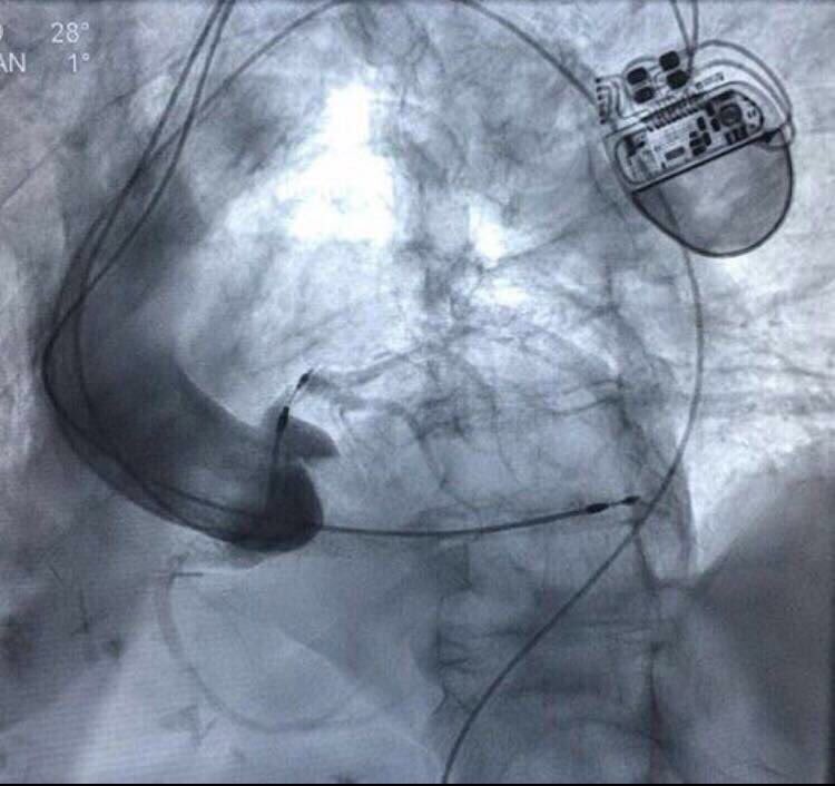 I think this should be labelled as a never event